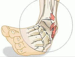 Durere în cauzele bolii piciorului inferior