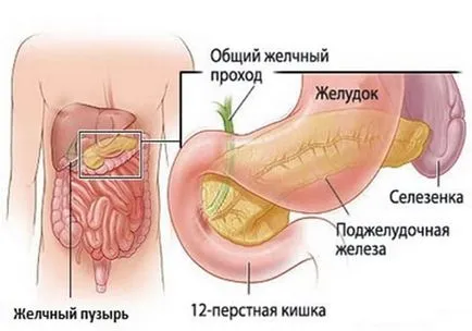 Deformarea vezicii biliare - cauzele și consecințele