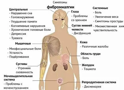 Фибромиалгия симптоми и лечение, се третират като у дома си