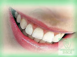 Implanturile dentare YUZAO - dinți de multe ori implantate în districtul de sud-vest (sud-vest)