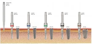 Mirell implantátumok (Mirelle) - véleménye, katalógus, árak