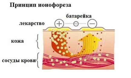 Йонофореза, фонофореза дома показания, противопоказания, оборудване