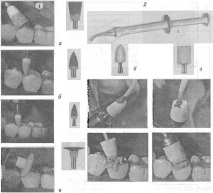 A csiszoló szerszámok és polírozó - Dental Instruments - Sebészet és