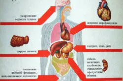 Колм странични ефекти, които могат да бъдат в лекарството на заетостта