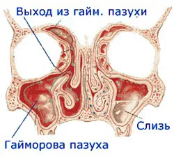 лечение синузит, физиотерапия у дома