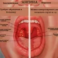 Лимфните възли под мишниците - възпаление, когато лимфните възли под мишниците