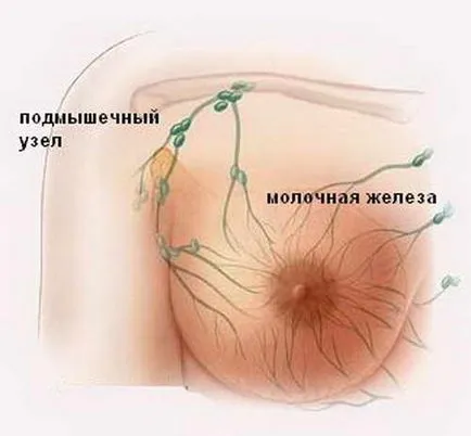 Лимфните възли под мишниците - възпаление, когато лимфните възли под мишниците