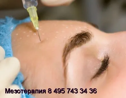 Mezoterapia ca metodă de tratament de acnee, cosmetologie