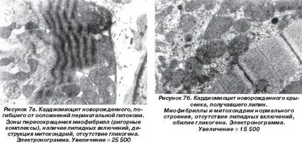 Nanotechnológia a kardiológiai gyakorlatban