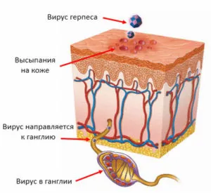 De foarte multe ori există un herpes pe buze - cauze