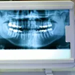 Caracteristici și caracteristici ale dentare piese de mână