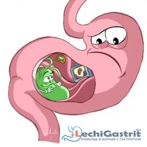 Diagnosticat gastrita antral - ceea ce este