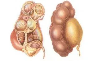 Motive de ce rănit testicule la bărbați, ce să facă cu durerea testiculare testicule