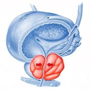 Motive de ce rănit testicule la bărbați, ce să facă cu durerea testiculare testicule