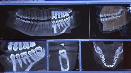 Сирона orthophos 3D и нови компютърна диагностика