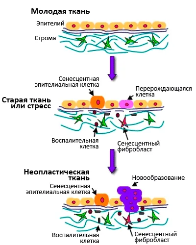 Стареене и рак - естеството на рак