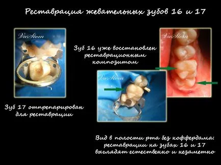 Centrul stomatologic „dentaldzhaz“ - vip elita Stomatologie din Moscova