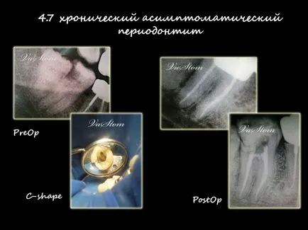 Centrul stomatologic „dentaldzhaz“ - vip elita Stomatologie din Moscova