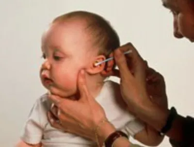 Copilul are urechi murdare în fiecare zi