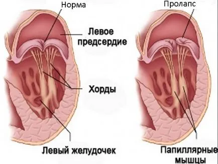 Szív ultrahang baba, gyerekek (echo kg)