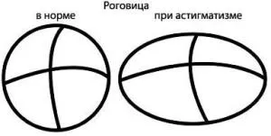 Timp pentru a diagnostica astigmatism - pentru a păstra sănătatea ochilor!