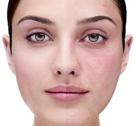 Askorutin faciale răspunsuri ale pielii, aplicarea, rezultate