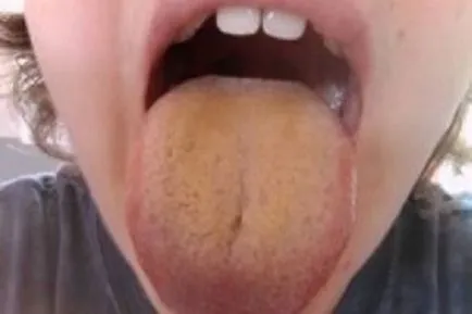 Boli care poate solicita limba