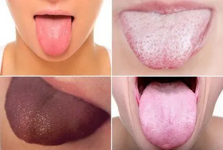 Boli care poate solicita limba