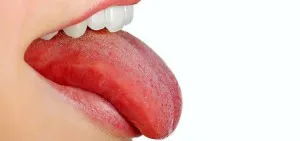 Sore cauze vârful limbii și de tratament pentru inflamație și furnicături