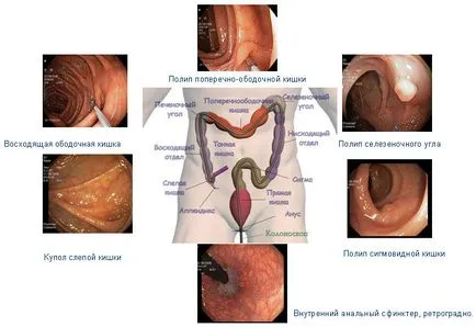 Centrul de diagnostic și tratament al bolilor tractului gastro-intestinal