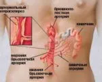 Диета при пациенти с коронарна болест на сърцето общите препоръки