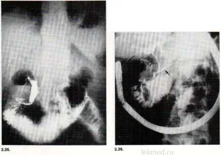 ERCP - Útmutató klinikai endoszkópos