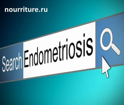 Az endometriózis egy orvosi kifejezés,