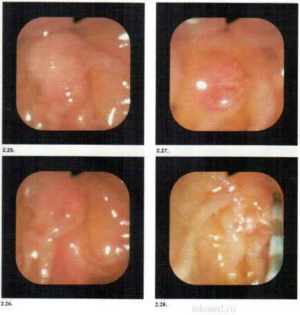 ERCP - Útmutató klinikai endoszkópos