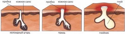 Se fierbe un tratament la domiciliu, căi de atac rapid populare