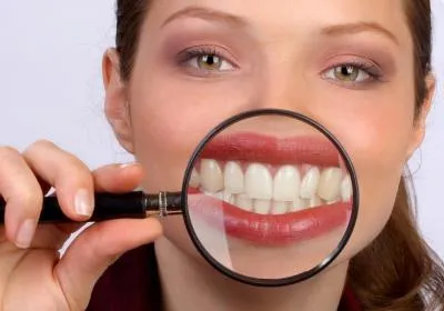 Какви продукти за избелване на зъбите