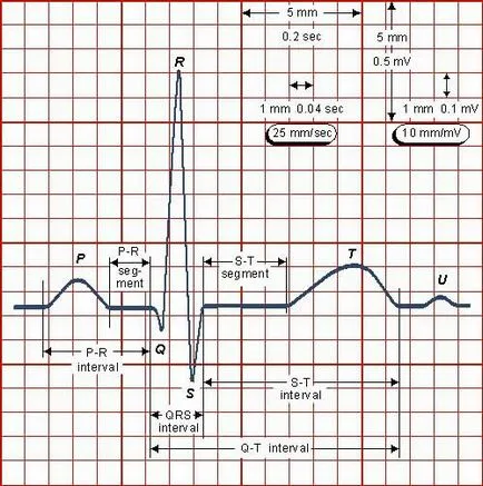 Cum de a citi o cardiograma, fac totul singur