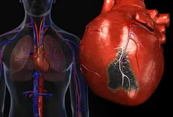 Cardio és annak következményei