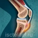 Cox arthritis - okai, tünetei és hatékony kezelése