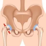 Cox arthritis - okai, tünetei és hatékony kezelése