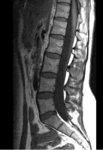 CT vagy MRI a gerinc, akkor jobb, ha szükség van, hogy a CT, MRI vagy az ultrahang a gerinc