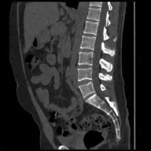 CT vagy MRI a gerinc, akkor jobb, ha szükség van, hogy a CT, MRI vagy az ultrahang a gerinc