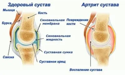 Tratamentul de boli ale genunchiului prin intermediul unor exerciții