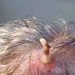 Myiasis ce este, pielea, intestinale, tip orală a unei persoane, foto și video