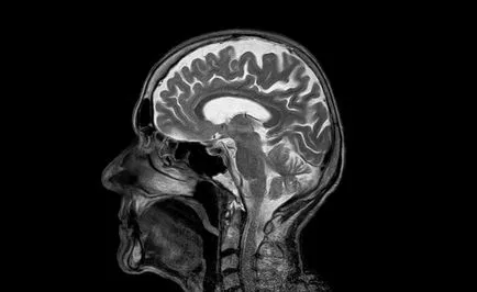 Tehetek egy MRI fém és fém-kerámia koronák - az árnyalatok az eljárás -