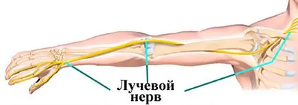 neuropatia nervului radial cauze, simptome si tratament, diagnostic la Kiev
