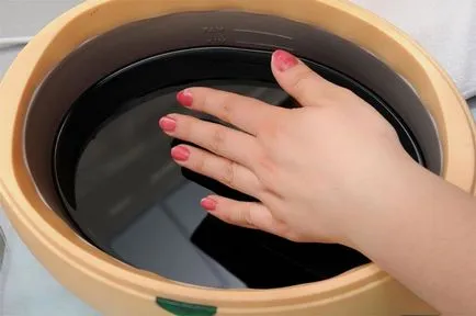 Frostbite kezek csinálni fagyás ujjai kezelésére emberek jogorvoslatok