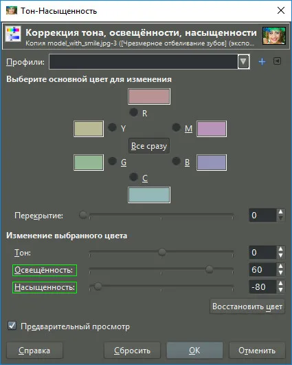 Избелване на зъбите изобразени в бродиране - 2 ефективни методи