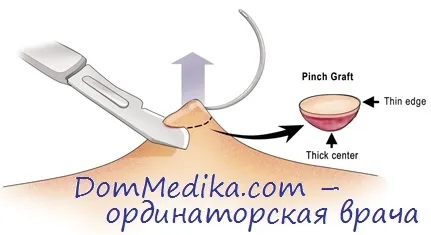 Gyűjtését, tárolását, a jelölést a biopsziás