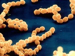 Streptococcus - ефективно лечение на Streptococcus